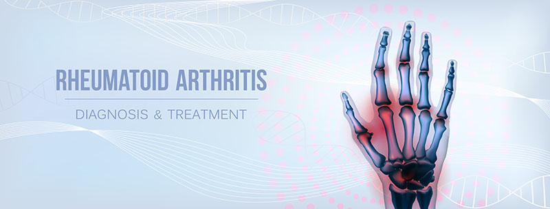 Infrared Sauna for Arthritis: The Evidence for Joint Pain Relief (2026 Research Review)