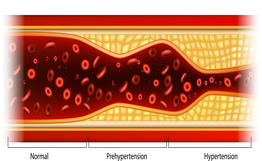 Infrared Saunas Cardiovascular Benefits SaunaCloud