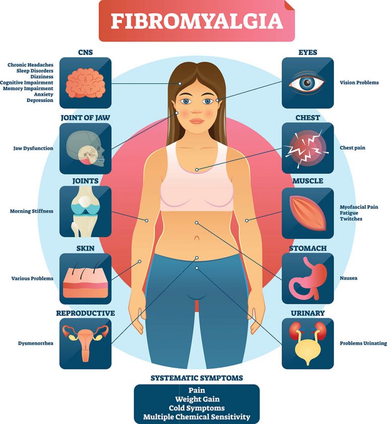 Esitellä 54+ imagen fibromyalgia sauna