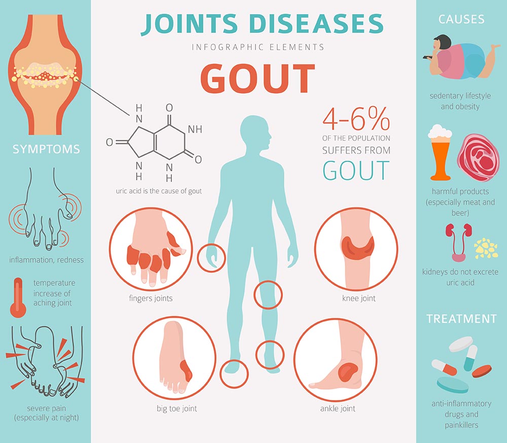 Benefits of Infrared Sauna Gout Treatment SaunaCloud