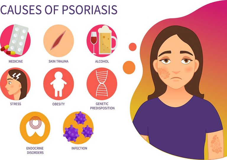 Infrared Saunas and Psoriasis - 2021 Guide