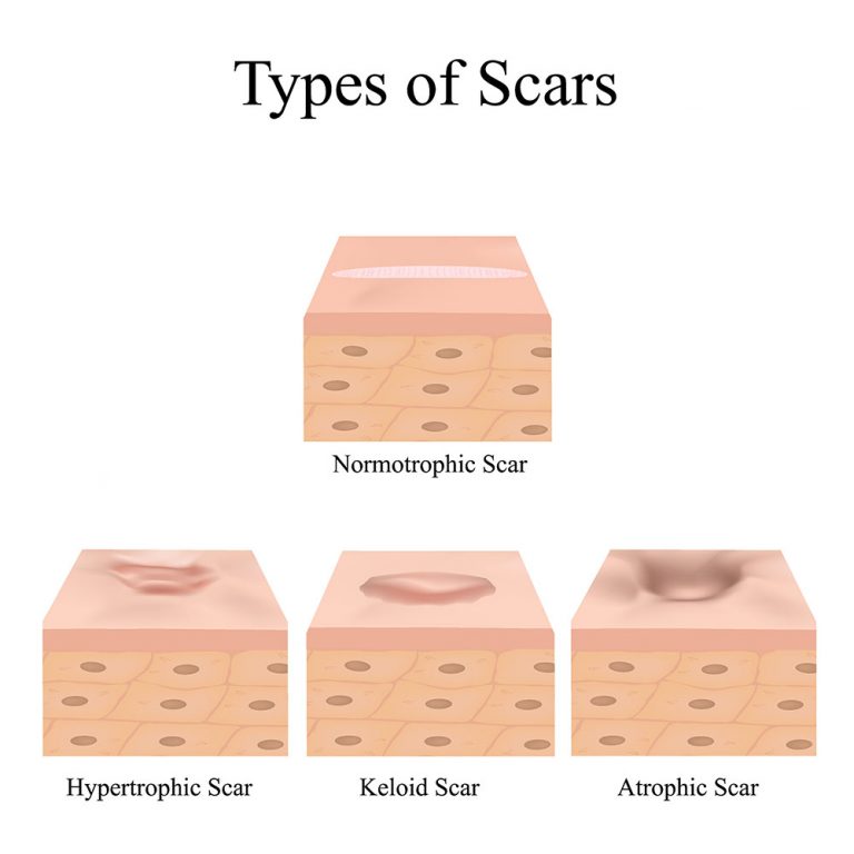 types of infrared heaters - full spectrum saunas